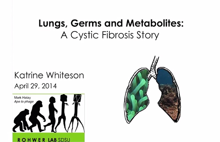 Lungs, Germs and Metabolites: A Cystic Fibrosis Story