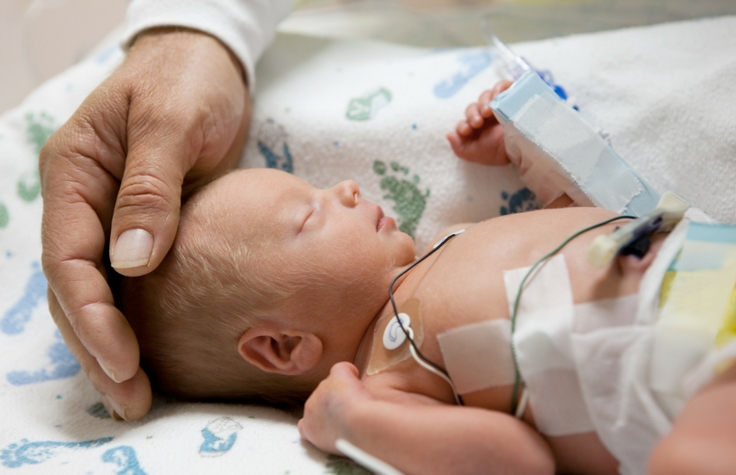 希少疾患が疑われる新生児を評価する試験 